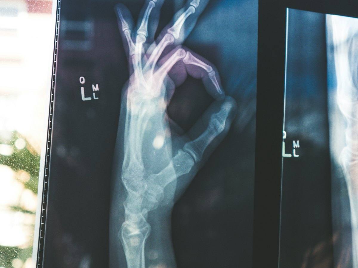 Radiologist reviewing an X-ray of a hand on a lightbox